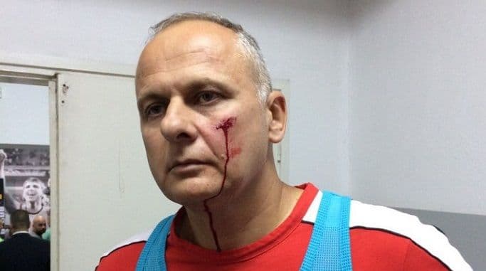 Saša Petrović pogođen kamenicom u glavu! Saša Petrović pogođen kamenicom u glavu!