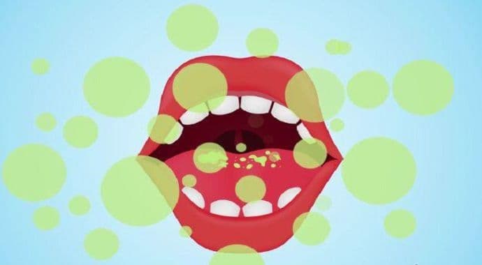 Jednostavna navika koja može da spriječi jutarnji zadah Jednostavna navika koja može da spriječi jutarnji zadah