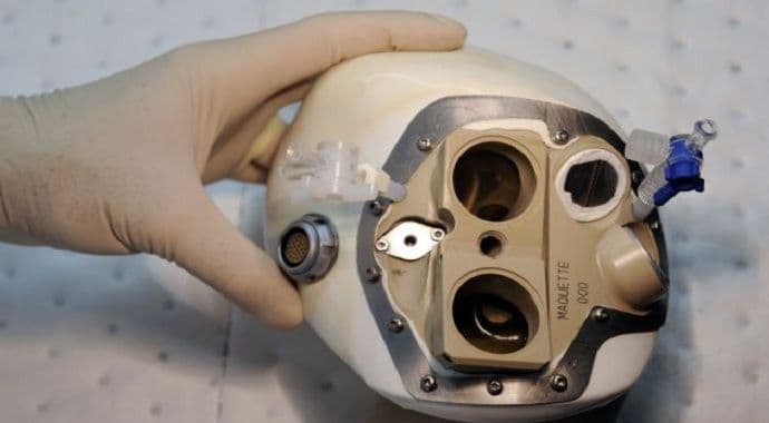 Ugradnja mehaničkog srca od sada i u Crnoj Gori Ugradnja mehaničkog srca od sada i u Crnoj Gori