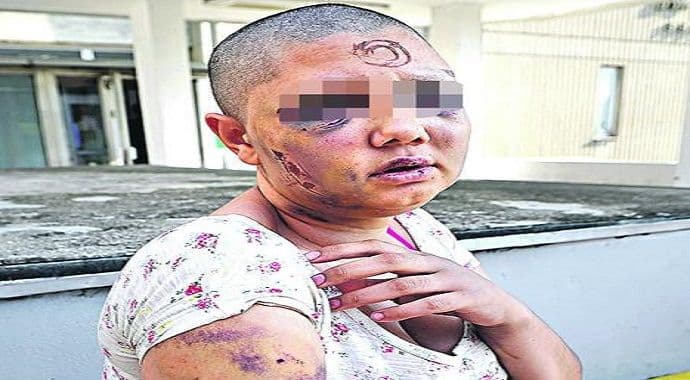 Stravična ispovijest žene iz Kaluđerice koju je muž zvjerski mučio danima Stravična ispovijest žene iz Kaluđerice koju je muž zvjerski mučio danima