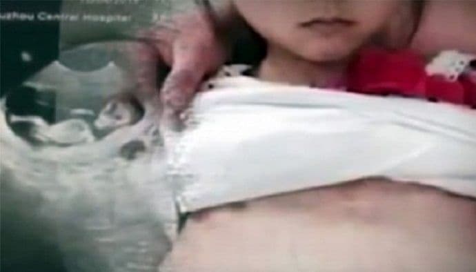 Doveo trudnu djevojčicu (12) u bolnicu, tvrdio da mu je supruga i da ima 20 godina Doveo trudnu djevojčicu (12) u bolnicu, tvrdio da mu je supruga i da ima 20 godina