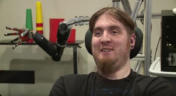 Nova robotska ruka: Prvi put nakon 10 godina osjetio dodir Nova robotska ruka: Prvi put nakon 10 godina osjetio dodir