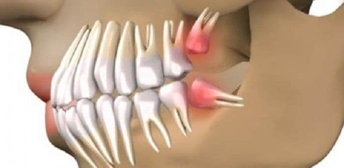 Senzacionalno otkriće: Novi zubi za 9 nedjelja Senzacionalno otkriće: Novi zubi za 9 nedjelja