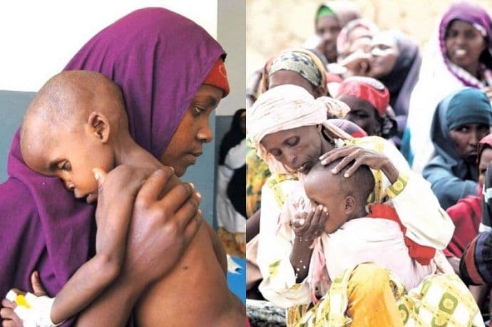 Od gladi svakog dana umre 20.000 ljudi Od gladi svakog dana umre 20.000 ljudi