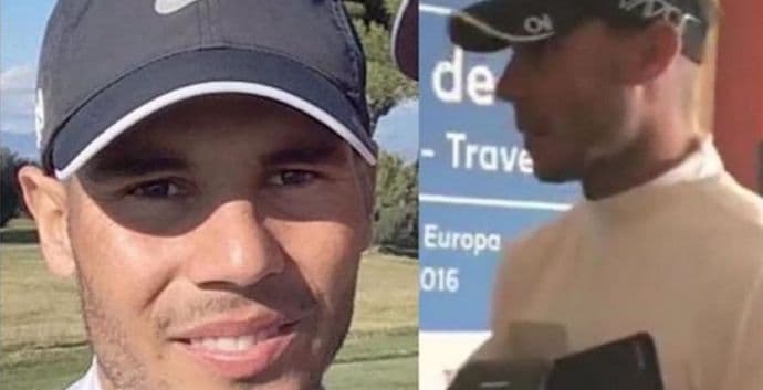 Nadal proveo 10 sati na operacionom stolu, a razlog je nevjerovatan Nadal proveo 10 sati na operacionom stolu, a razlog je nevjerovatan