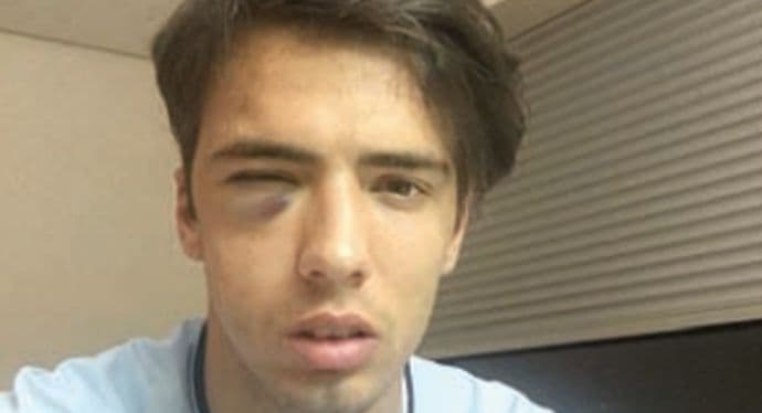 Bakić teže povrijeđen na meču sa Elćeom Bakić teže povrijeđen na meču sa Elćeom