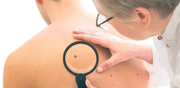 CDPR organizuje besplatan pregled kože CDPR organizuje besplatan pregled kože