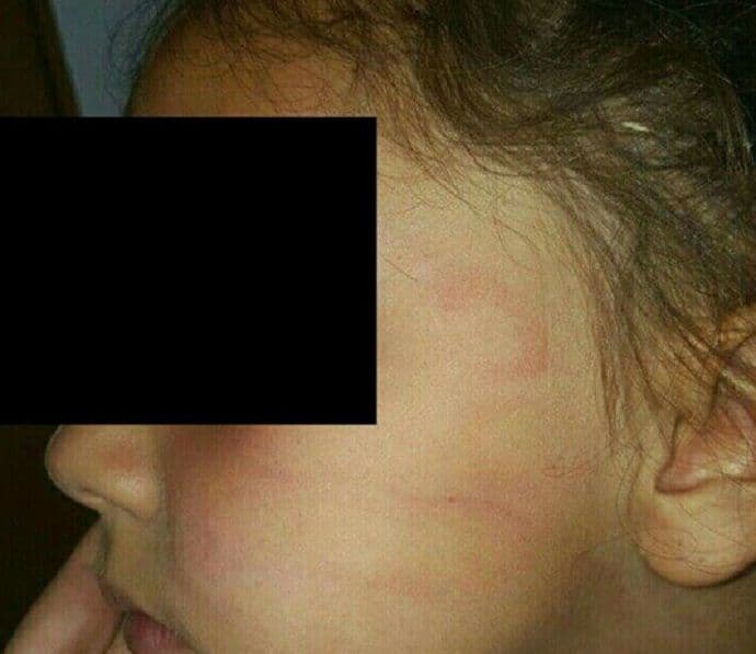 Šavnik: Nastavnik ošamario osmogodišnju učenicu? Šavnik: Nastavnik ošamario osmogodišnju učenicu?