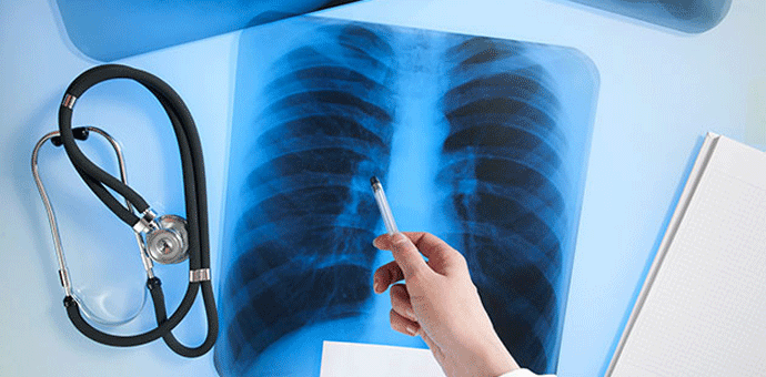 Pacijenti će opis radiološkog snimka dobiti istog dana Pacijenti će opis radiološkog snimka dobiti istog dana