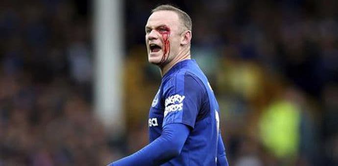 Runi u krvi, nije dobio ni faul Runi u krvi, nije dobio ni faul