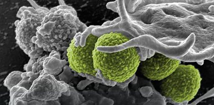 SZO objavila listu 12 bakterija koje su postale neuništive SZO objavila listu 12 bakterija koje su postale neuništive