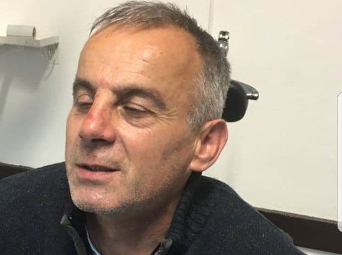 Kandidat za odbornika Demokrata pretukao aktivistu DPS Kandidat za odbornika Demokrata pretukao aktivistu DPS