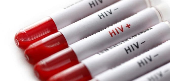 Naučnici iz Hongkonga tvrde da su pronašli novi lijek za HIV Naučnici iz Hongkonga tvrde da su pronašli novi lijek za HIV