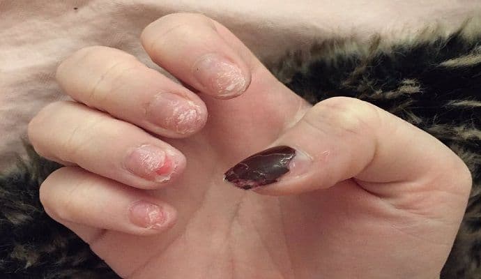 Evo kako izgledaju nokti nakon šest godina izlivanja gela Evo kako izgledaju nokti nakon šest godina izlivanja gela