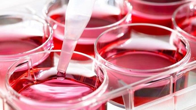 Liječenje matičnim ćelijama sve prisutnije u kliničkoj praksi Liječenje matičnim ćelijama sve prisutnije u kliničkoj praksi