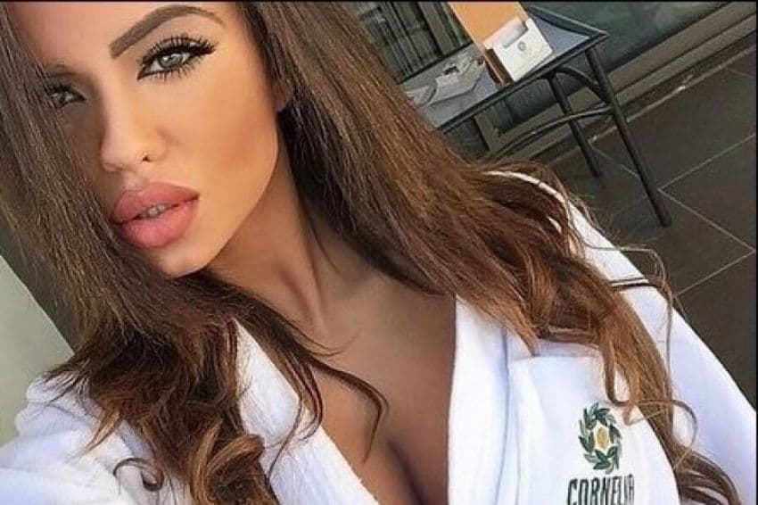 Hirurzi se bore da sačuvaju nogu španskoj misici koja je umalo stradala u eksploziji Hirurzi se bore da sačuvaju nogu španskoj misici koja je umalo stradala u eksploziji