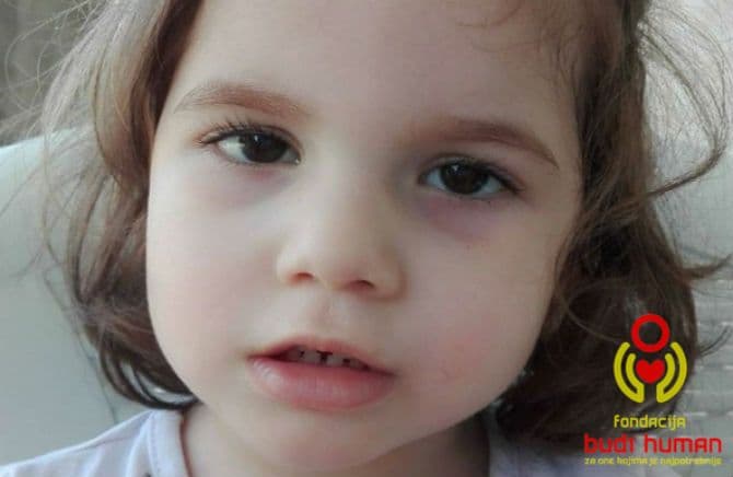 Četvorogodišnjoj Ivi je potrebna pomoć Četvorogodišnjoj Ivi je potrebna pomoć