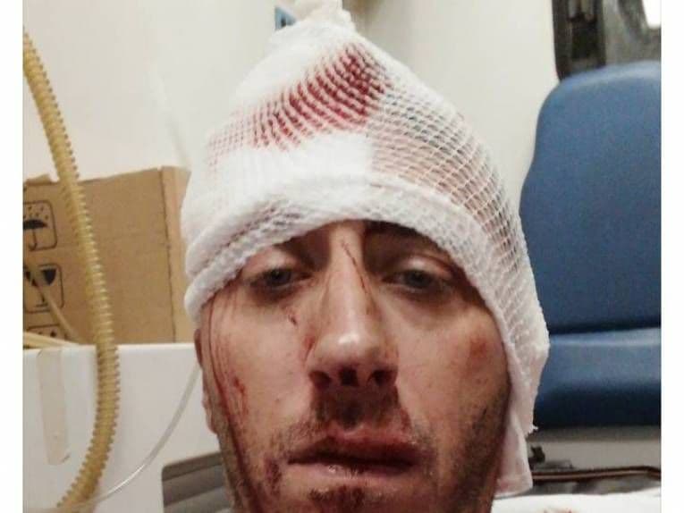 Brutalno pretučen novinar Vladimir Kovačević Foto: BN TV