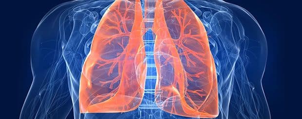 Kancer pluća odnosi najviše života  Kancer pluća odnosi najviše života