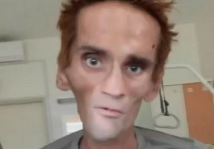 Uskoro sudski epilog: Brutalno ga mučili, izbijali mu zube, lomili rebra i čekićem tukli po rukama Uskoro sudski epilog: Brutalno ga mučili, izbijali mu zube, lomili rebra i čekićem tukli po rukama