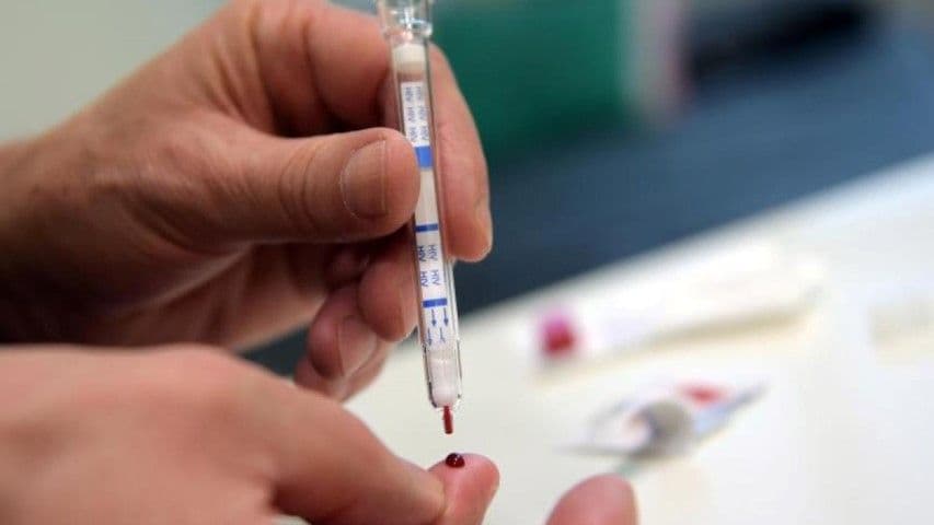 Zbog HIV statusa ostaju i bez posla Zbog HIV statusa ostaju i bez posla