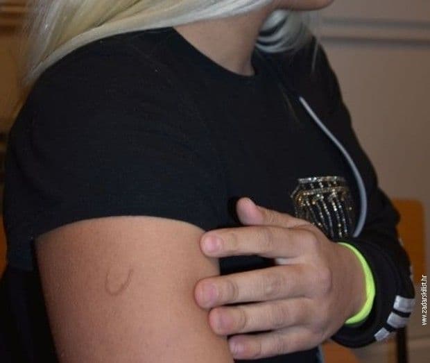 Drugaricu žigosao ustaškim simbolom Zadarski list