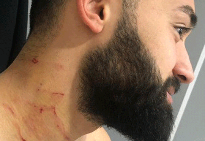 Turski fudbaler žiletom napao protivnike na terenu (VIDEO) Ferhat Jazgan