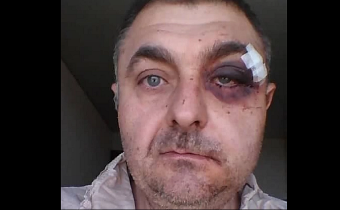 Otac djevojčice sa Daunovim sindromom zamolio taksistu da se pomjeri a on ga brutalno pretukao Otac djevojčice sa Daunovim sindromom zamolio taksistu da se pomjeri a on ga brutalno pretukao