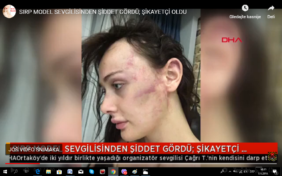 Srpsku manekenku pretukao momak u Turskoj Srpsku manekenku pretukao momak u Turskoj