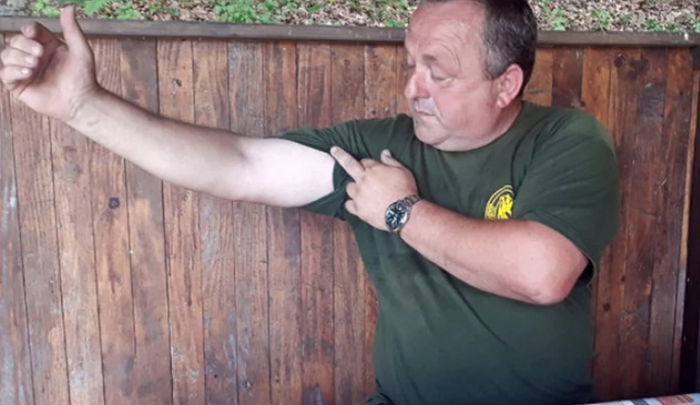 Preživio 67 uboda stršljenova : Kao da su u mene zabijali eksere Preživio 67 uboda stršljenova : Kao da su u mene zabijali eksere