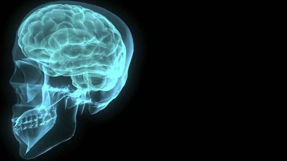 Potvrđene promjene na mozgu američkih diplomata koji su radili na Kubi Snimak mozga