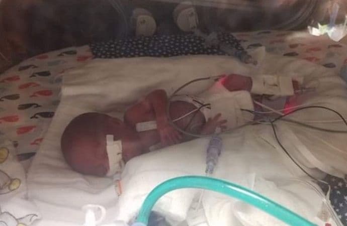 Četiri mjeseca prije termina rodila bebu tešku 360 grama: “Naše malo čudo" Četiri mjeseca prije termina rodila bebu tešku 360 grama: “Naše malo čudo"