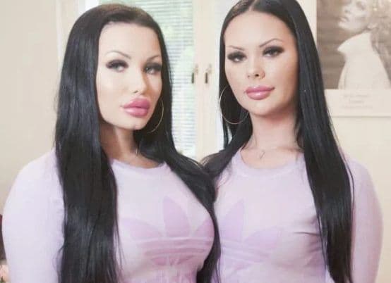 Najbolje drugarice odlučile da se operišu i postanu bliznakinje Najbolje drugarice odlučile da se operišu i postanu bliznakinje