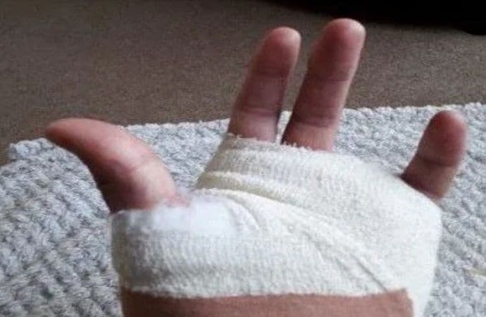 Engleski trener na bizaran način ostao bez prsta nakon utakmice Engleski trener na bizaran način ostao bez prsta nakon utakmice