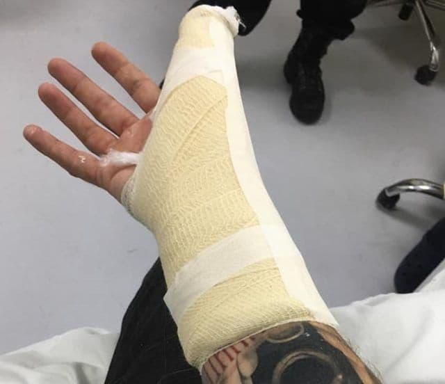 Prava Crna Gora: Policija Milačiću polomila prst Prava Crna Gora: Policija Milačiću polomila prst