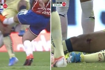 Stravična povreda bivšeg asa Barse Stravična povreda bivšeg asa Barse