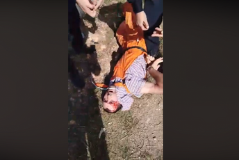 Uhapšen jer je udario policajca,ali i povrijedjen tokom policijske akcije Uhapšen jer je udario policajca,ali i povrijedjen tokom policijske akcije