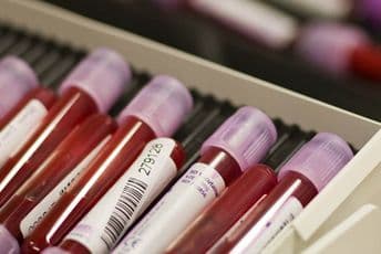 Test krvi otkriva rak dojke pet godina prije pojave simptoma REUTERS/Valentin Flauraud