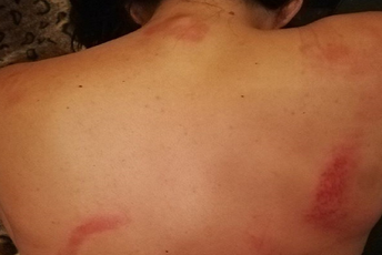 Svjedoci tvrde da policajac nije pomogao pretučenoj djevojci Foto: Sigurna ženska kuća