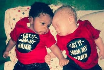 Rodila blizance- jedan tamnoput, drugi ima bijelu kožu Rodila blizance- jedan tamnoput, drugi ima bijelu kožu