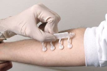 Uskoro bez zakazivanja imunoloških testiranja Uskoro bez zakazivanja imunoloških testiranja