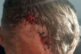 PODGORICA: Uhapšeno 45 huligana zbog napada na policiju PODGORICA: Uhapšeno 45 huligana zbog napada na policiju