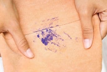 Kako se riješiti mrlja od tinte, krvi, masti ili laka za nokte? Kako se riješiti mrlja od tinte, krvi, masti ili laka za nokte?