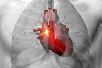 Prepoznajte sindrom nervoznog srca Prepoznajte sindrom nervoznog srca
