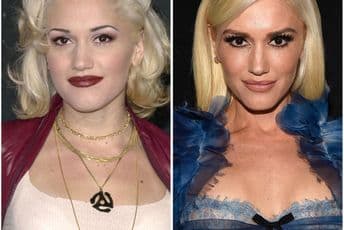 Pjevačica na udaru kritika zbog estetskih operacija Foto: Avaz