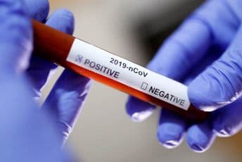 Veliki pomak, italijanski naučnici izolovali koronavirus Foto: REUTERS/Dado Ruvic