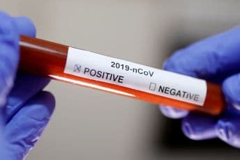 Unuk nekadašnjeg austrougarskog cara zaražen korona virusom Unuk nekadašnjeg austrougarskog cara zaražen korona virusom