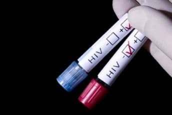 Prvi pacijent izliječen od HIV-a - umro od raka Prvi pacijent izliječen od HIV-a - umro od raka