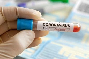 Stiglo 2.000 testova na koronavirus, donacije Kine i Turske Stiglo 2.000 testova na koronavirus, donacije Kine i Turske