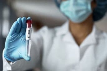 SRBIJA : Još 14 slučajeva koronavirusa, ukupno 149 SRBIJA : Još 14 slučajeva koronavirusa, ukupno 149